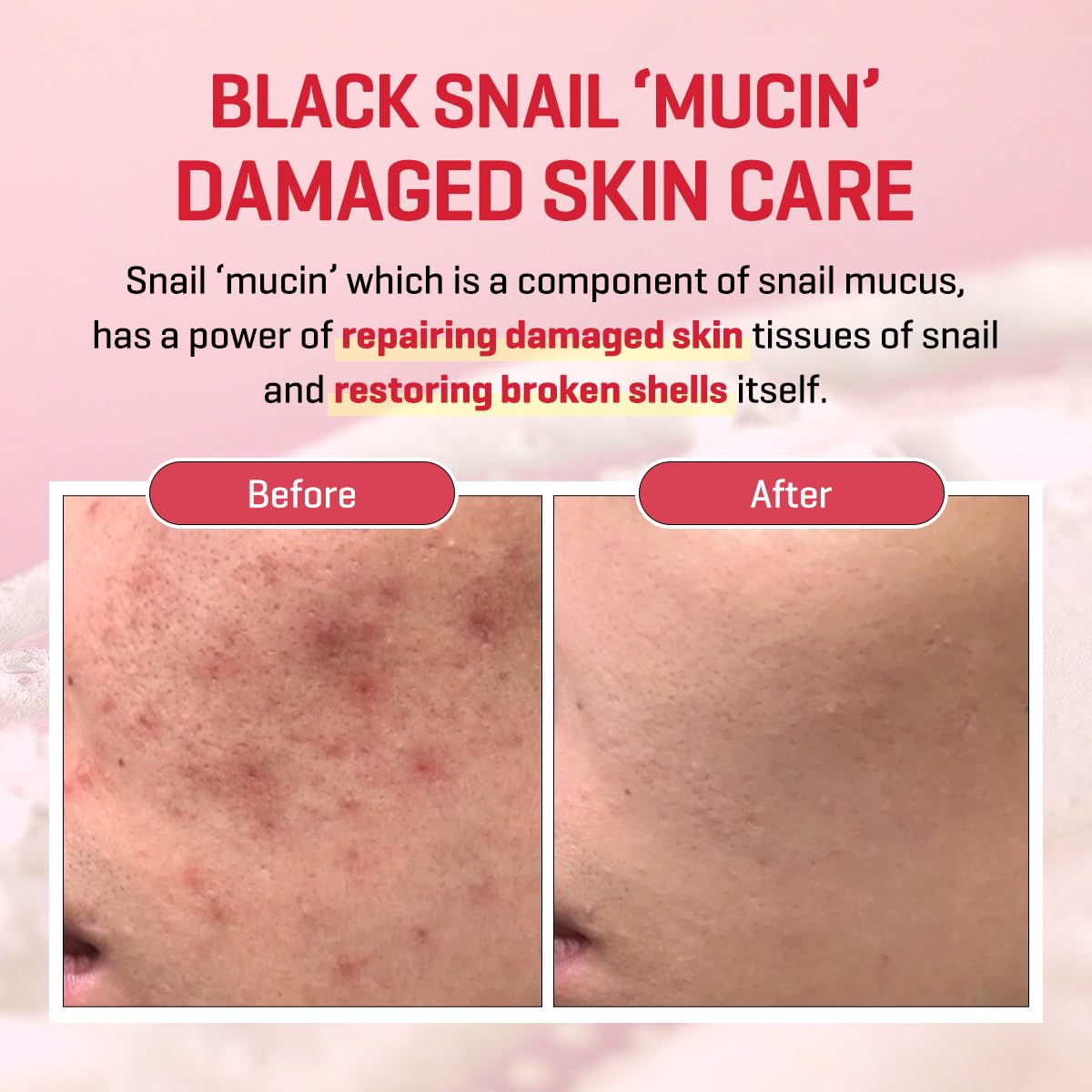 SOME BY MI Snail Truecica Miracle Serum 50ml | Lakinza K - beauty Canada