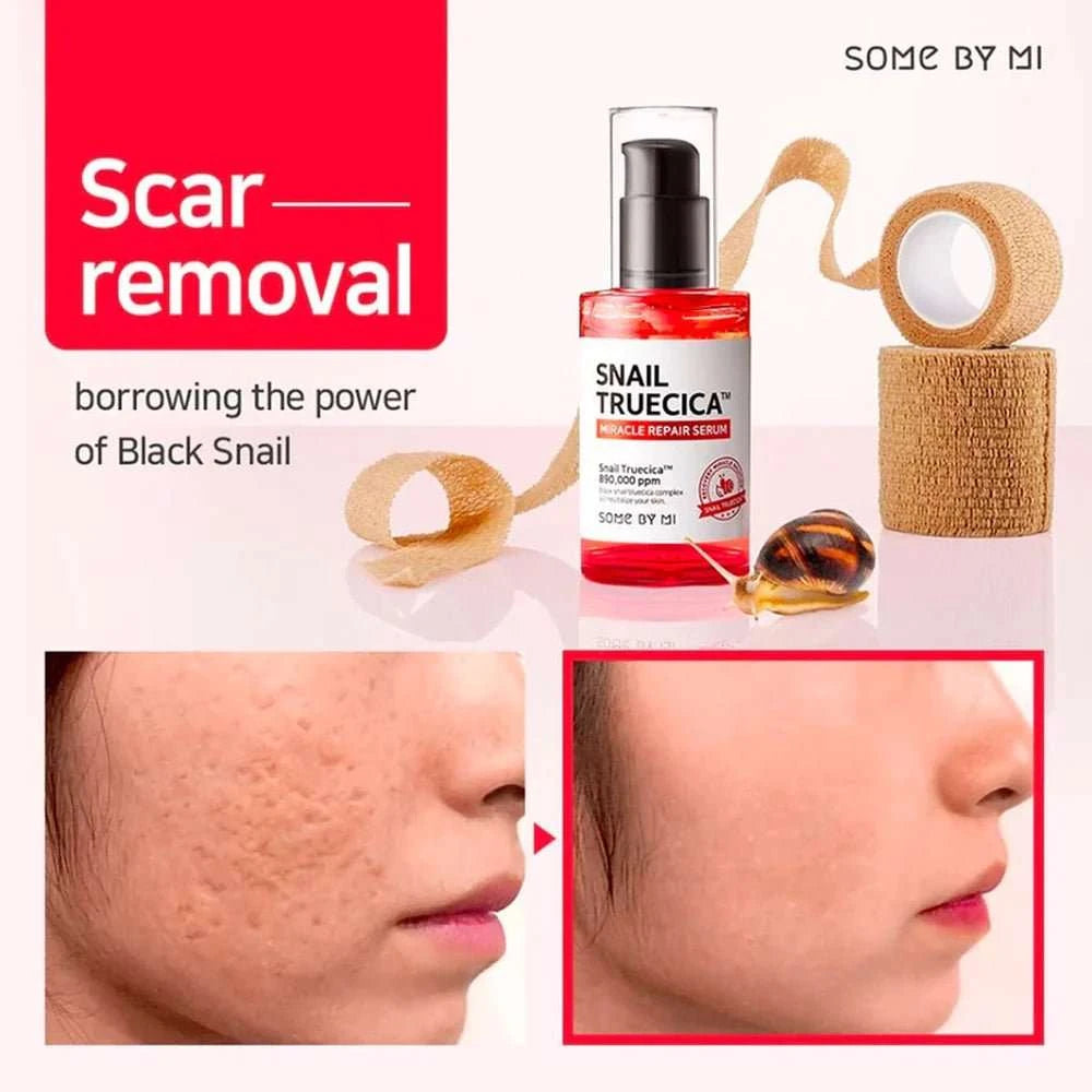 SOME BY MI Snail Truecica Miracle Skin Repair Set Lakinza K-beauty