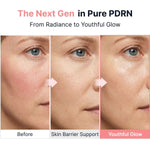 Sungboon Editor PDRN Pink Vitamin Glow Boosting Ampoule 40ml Lakinza K-beauty