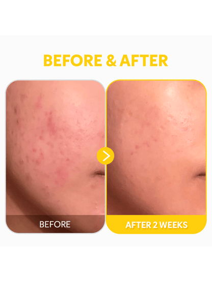 TIRTIR Pure Vitamin C 24 Serum 30ml