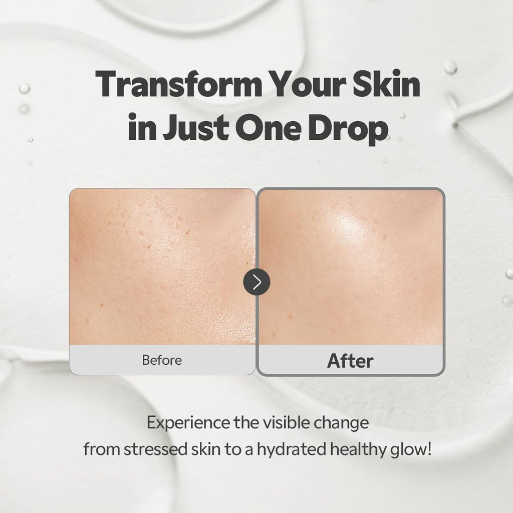 TIRTIR SOS Serum 50ml | Lakinza K - beauty Canada