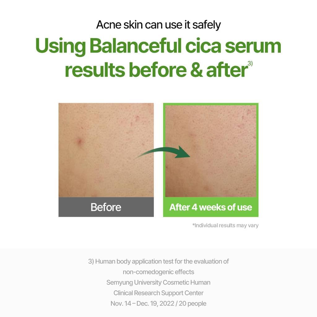 Torriden Balanceful Cica Serum 10ml | Lakinza K - beauty Canada