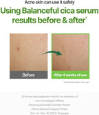 Torriden Balanceful Cica Serum 50ml | Lakinza K - beauty Canada