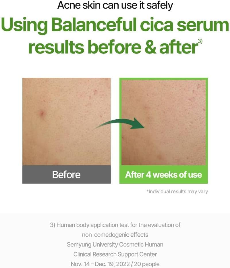 Torriden Balanceful Cica Serum 50ml | Lakinza K - beauty Canada
