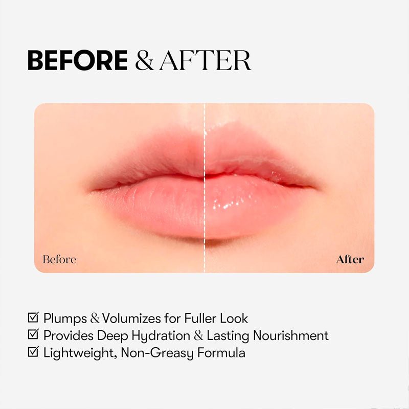 VT Reedle Shot Lip Plumper 4ml - Beginner Lakinza K-beauty